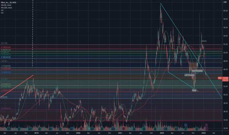 PFE Stock: Guidance Up, Sales Down - What's the Catch?